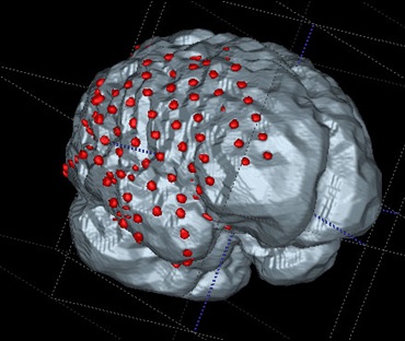 brain mapping